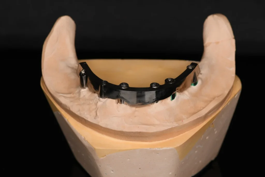 All-on-X-Zirconia-on-Ti-Bar-–-Lower-Arch-4
